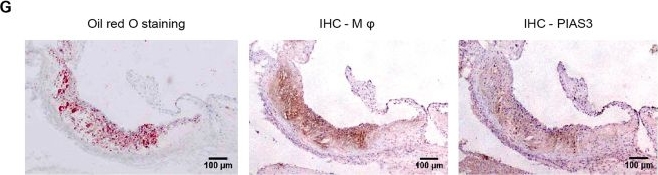 Fig.1.G showing Immunohistochemistry in a Mus musculus (House mouse) sample from the publication: Protein Inhibitor of Activated STAT3 Suppresses Oxidized LDL-induced Cell Responses during Atherosclerosis in Apolipoprotein E-deficient Mice.