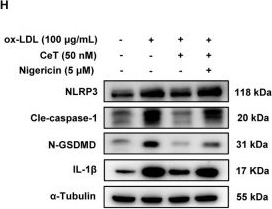 Fig.3.H showing Western Blotting from the publication: Celastrol ameliorates atherosclerosis by inhibiting TLR4/STAT3/NLRP3-mediated macrophage pyroptosis.