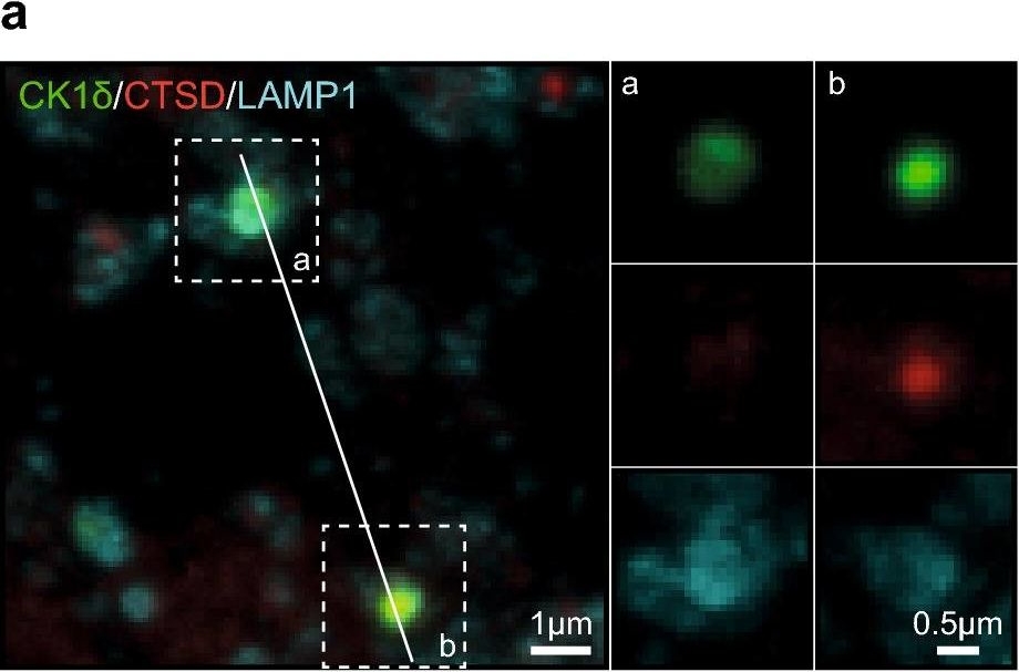 Fig.6.A showing Immunohistochemistry-paraffin-immunofluorescence in a Mus musculus (House mouse) sample from the publication: Granulovacuolar degeneration bodies are neuron-selective lysosomal structures induced by intracellular tau pathology.