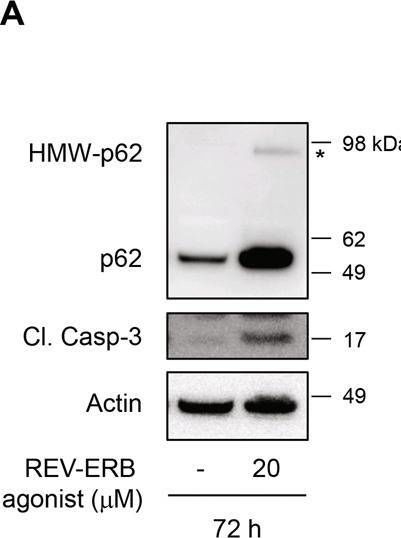 The nuclear receptor REV-ERBα is implicated in the alteration of β-cell autophagy and survival under diabetogenic conditions.