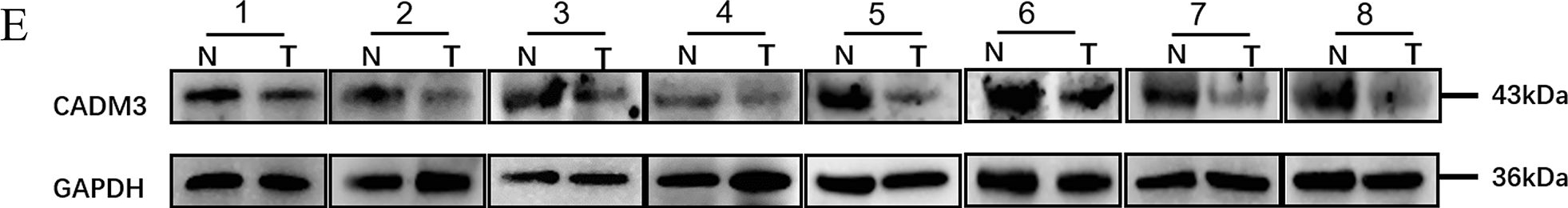 Fig.1.E showing Western Blotting in a Homo sapiens (Human) sample from the publication: Clinical significance of low expression of CADM3 in breast cancer and preliminary exploration of related mechanisms.
