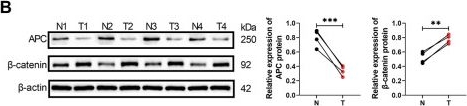 Fig.2.B showing Western Blotting from the publication: STT3A-mediated FCN3 N-glycosylation promotes Treg cell activation to drive hepatocellular carcinoma progression via Wnt/β-catenin.