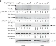 Fig.6.B showing Western Blotting from the publication: Biallelic JAK1 mutations in immunodeficient patient with mycobacterial infection.
