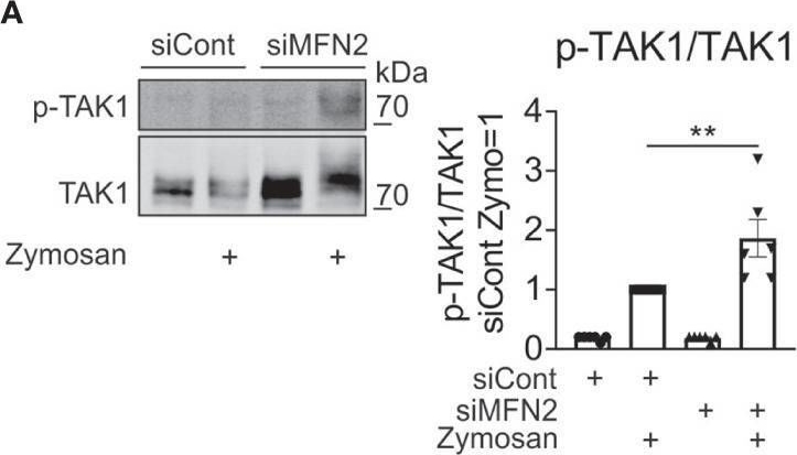 Fig.6.A showing Western Blotting from the publication: Mitofusin 2 Deficiency Causes Pro-Inflammatory Effects in Human Primary Macrophages.