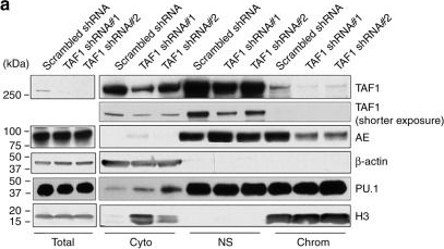 Fig.7.A showing Western Blotting in a Homo sapiens (Human) sample from the publication: TAF1 plays a critical role in AML1-ETO driven leukemogenesis.