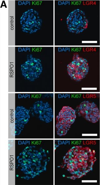Fig.13.A showing Immunocytochemistry-immunofluorescence in a Mus musculus (House mouse) sample from the publication: R-Spondin1 Regulates Fate of Enteric Neural Progenitors via Differential LGR4/5/6 Expression in Mice and Humans.