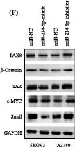 Fig.1.F showing Western Blotting in a Homo sapiens (Human) sample from the publication: Adipose-Derived Mesenchymal Stem Cells Reduce miR-214-5p to Promote Ovarian Cancer Progression via the β-Catenin Pathway by Targeting PAX8.