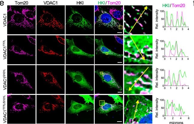 Fig.7.E showing Immunocytochemistry-immunofluorescence in a Homo sapiens (Human) sample from the publication: Hexokinase-I directly binds to a charged membrane-buried glutamate of mitochondrial VDAC1 and VDAC2.