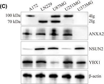 Fig.1.C showing Western Blotting from the publication: Generation of B7-H3 isoform regulated by ANXA2/NSUN2/YBX1 axis in human glioma.