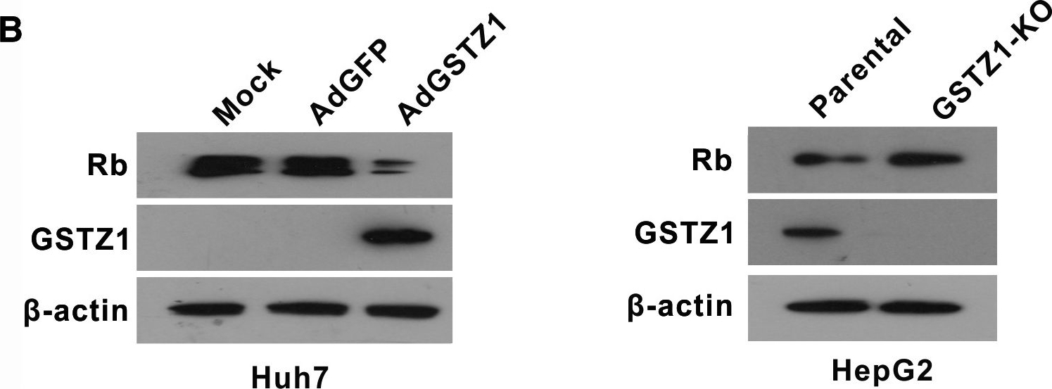Fig.4.B showing Western Blotting in a Homo sapiens (Human) sample from the publication: GSTZ1-1 downregulates Wnt/β-catenin signalling in hepatocellular carcinoma cells.