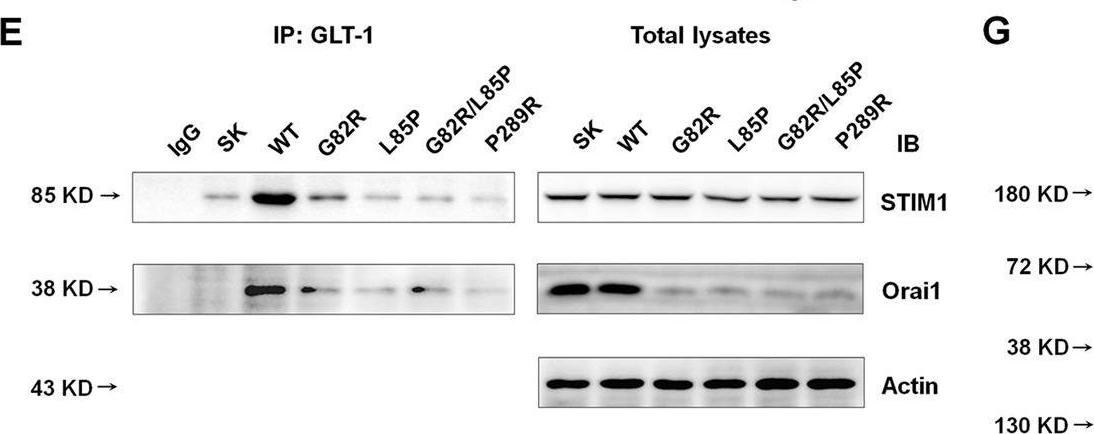Fig.4.E showing Western Blotting from the publication: Functional investigation of SLC1A2 variants associated with epilepsy.