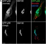 Fig.4.A showing Immunocytochemistry-immunofluorescence from the publication: Epistatic Interplay between Type IV Secretion Effectors Engages the Small GTPase Rab2 in the Brucella Intracellular Cycle.