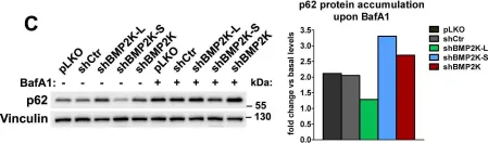 Fig.4.C showing Western Blotting from the publication: Splicing variation of BMP2K balances abundance of COPII assemblies and autophagic degradation in erythroid cells.