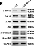 Fig.2.E showing Western Blotting from the publication: HCC-derived exosomes elicit HCC progression and recurrence by epithelial-mesenchymal transition through MAPK/ERK signalling pathway.