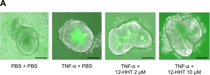 Fig.5.A from the publication: 12-HHT is associated with epithelial barrier enhancement and reduced inflammatory responses in colon organoids of normoganglionosis in Hirschsprung's disease.