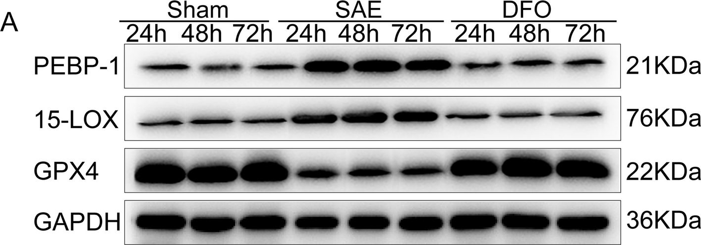 Fig.5.A showing Western Blotting from the publication: Lipid peroxidation-induced ferroptosis as a therapeutic target for mitigating neuronal injury and inflammation in sepsis-associated encephalopathy: insights into the hippocampal PEBP-1/15-LOX/GPX4 pathway.