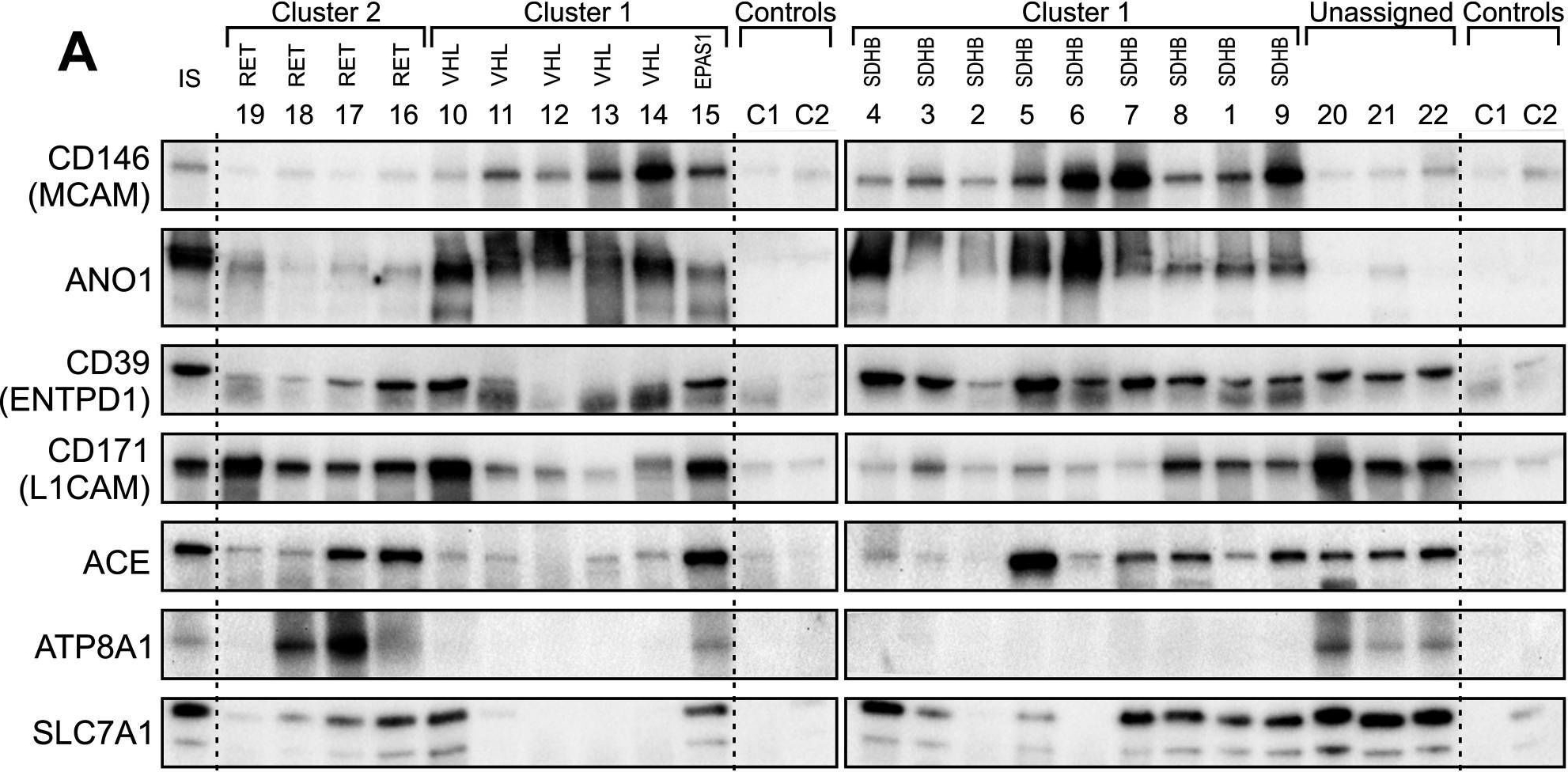 Fig.5.A showing Western Blotting in a Homo sapiens (Human) sample from the publication: Identification of potential molecular targets for the treatment of cluster 1 human pheochromocytoma and paraganglioma via comprehensive proteomic characterization.