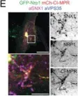 Fig.3.E showing Immunohistochemistry-immunofluorescence from the publication: ESCPE-1 mediates retrograde endosomal sorting of the SARS-CoV-2 host factor Neuropilin-1.