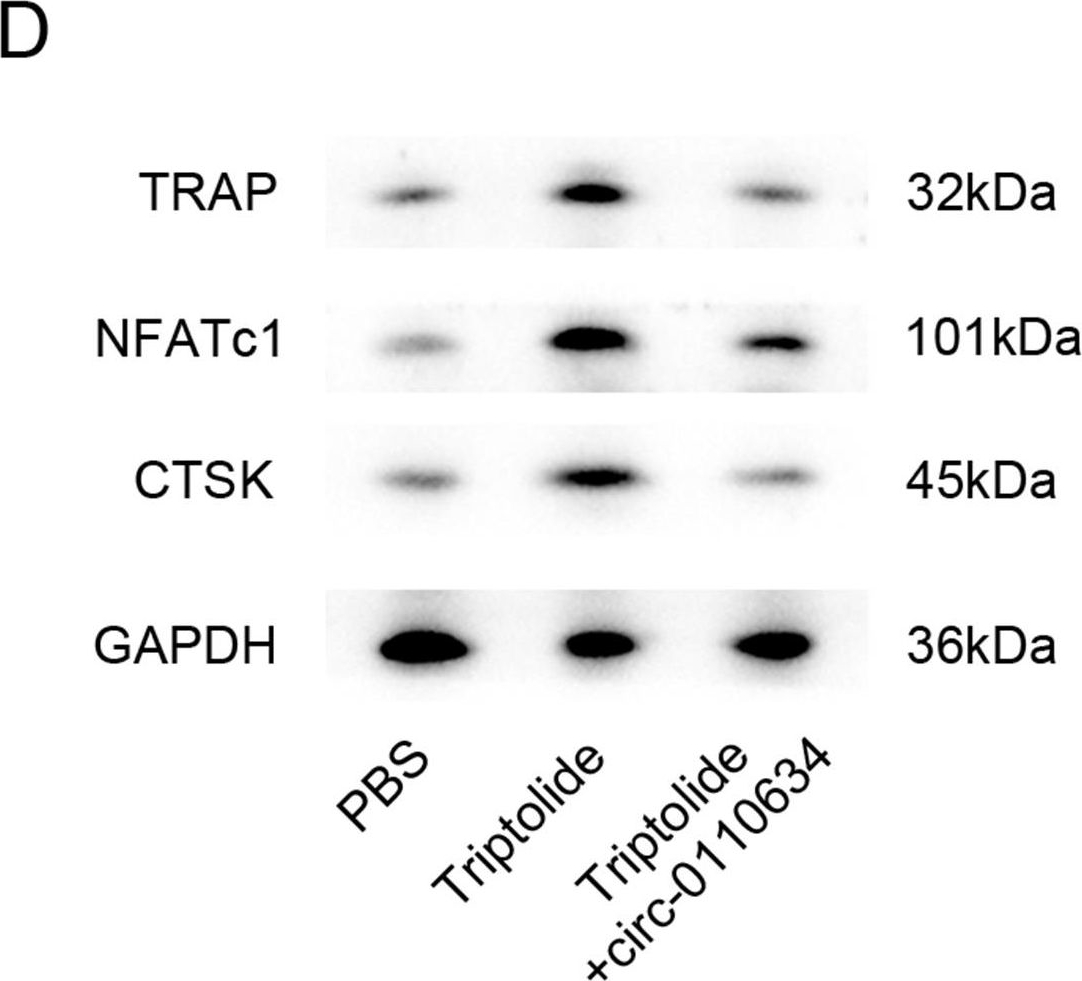 Fig.7.D showing Western Blotting in a Homo sapiens (Human) sample from the publication: Triptolide attenuates inhibition of ankylosing spondylitis-derived mesenchymal stem cells on the osteoclastogenesis through modulating exosomal transfer of circ-0110634.