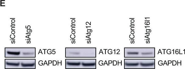 Fig.6.E showing Western Blotting from the publication: A new vulnerability to BET inhibition due to enhanced autophagy in BRCA2 deficient pancreatic cancer.