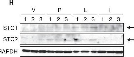 Fig.6.H showing Western Blotting in a Mus musculus (House mouse) sample from the publication: Lactation opposes pappalysin-1-driven pregnancy-associated breast cancer.
