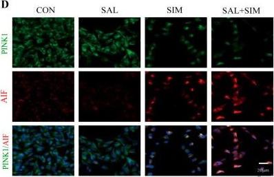 Fig.6.D showing Immunocytochemistry-immunofluorescence in a Homo sapiens (Human) sample from the publication: Salidroside Protects Against Simazine-Induced Neurotoxicity by Activating PINK1/Parkin Mitophagy.