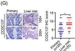 Fig.7.G showing Immunohistochemistry from the publication: CDK12 orchestrates super-enhancer-associated CCDC137 transcription to direct hepatic metastasis in colorectal cancer.