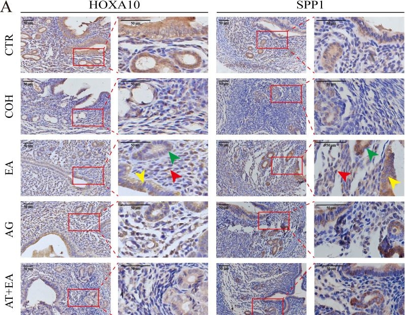 Fig.7.A showing Immunohistochemistry from the publication: Electroacupuncture may improve endometrial receptivity in controlled ovarian hyperstimulation mice by activating AVP neurons.