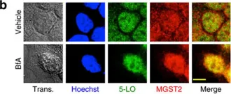 Fig.1.B showing Immunocytochemistry-immunofluorescence in a Homo sapiens (Human) sample from the publication: Leukotriene C4 is the major trigger of stress-induced oxidative DNA damage.