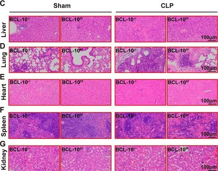 Fig.7.C showing Immunohistochemistry from the publication: Emodin Alleviates Sepsis-Induced Multiorgan Damage by Inhibiting NETosis through Targeting Neutrophils BCL-10.