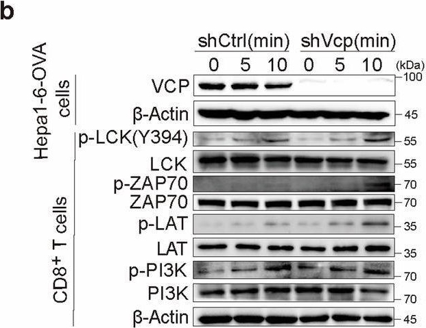 Fig.5.B showing Western Blotting in a Homo sapiens (Human) sample from the publication: VCP downstream metabolite glycerol-3-phosphate (G3P) inhibits CD8+T cells function in the HCC microenvironment.