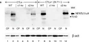 Fig.1.B showing Western Blotting in a Mus musculus (House mouse) sample from the publication: The Transcription Factor NFATc1 Supports the Rejection of Heterotopic Heart Allografts.