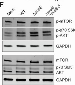 Fig.5.F showing Western Blotting from the publication: Salmonella Typhi asparaginase-dependent activation of GCN2 promotes bacterial killing in murine macrophages.