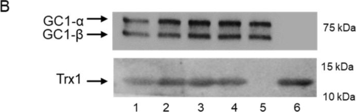Fig.3.B showing Western Blotting in a Homo sapiens (Human) sample from the publication: Inhibitory Peptide of Soluble Guanylyl Cyclase/Trx1 Interface Blunts the Dual Redox Signaling Functions of the Complex.