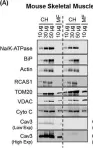 Fig.1.A showing Western Blotting from the publication: Caveolin-3 deficiency associated with the dystrophy P104L mutation impairs skeletal muscle mitochondrial form and function.