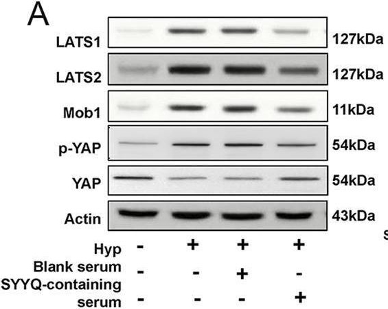 Fig.6.A showing Western Blotting from the publication: Mechanism of Shenyuan Yiqi Huoxue capsule alleviating coronary microvascular dysfunction: network analysis and experimental evidence.