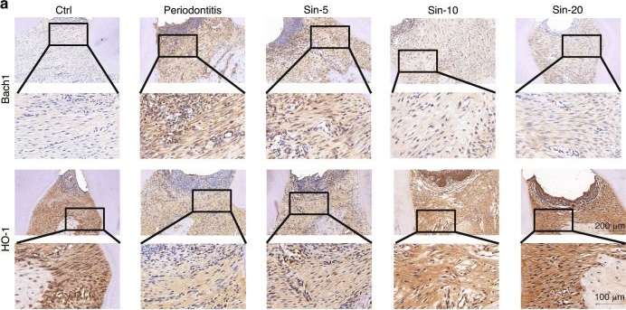 Fig.6.A showing Immunohistochemistry in a Rattus norvegicus (Rat) sample from the publication: Sinensetin protects against periodontitis through binding to Bach1 enhancing its ubiquitination degradation and improving oxidative stress.