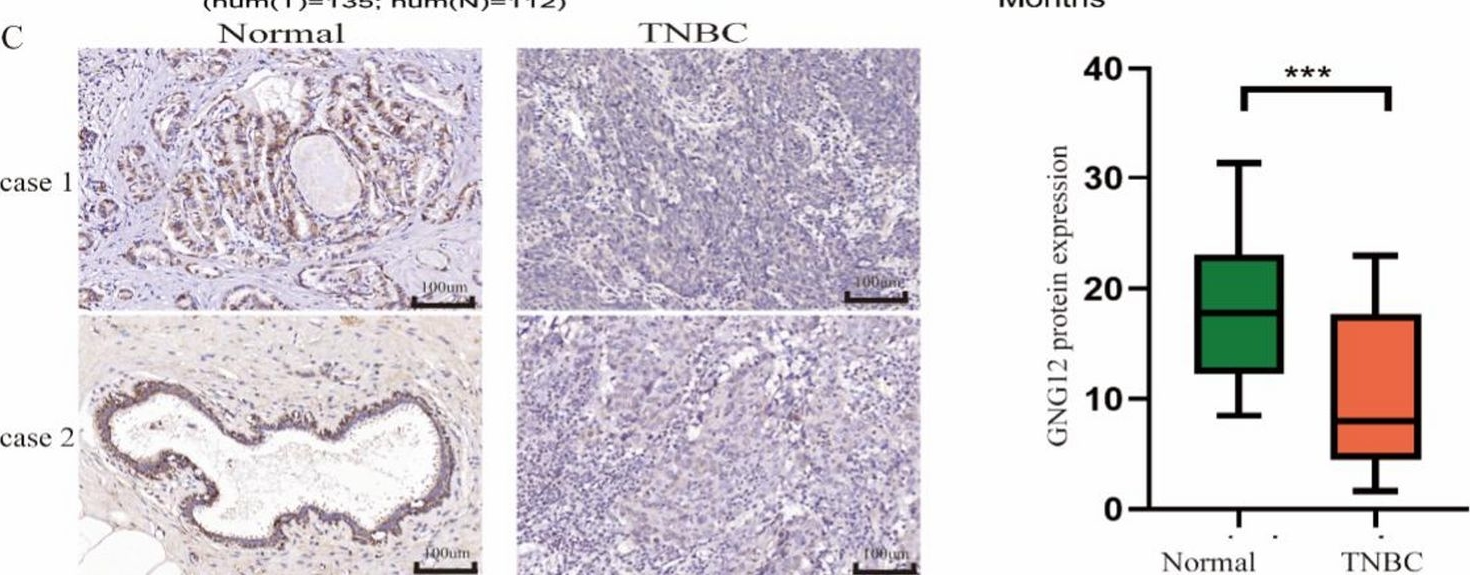 Fig.5.C showing Immunohistochemistry from the publication: GNG12 overexpression inhibits triple-negative breast cancer cell proliferation, migration, and invasion.