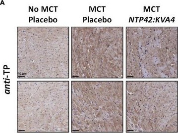 Fig.6.A showing Immunohistochemistry in a Rattus norvegicus (Rat) sample from the publication: The thromboxane receptor antagonist NTP42 promotes beneficial adaptation and preserves cardiac function in experimental models of right heart overload.