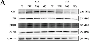 Fig.5.A showing Western Blotting from the publication: Mitochondrial Oxidative Stress Induces Cardiac Fibrosis in Obese Rats through Modulation of Transthyretin.