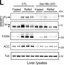 Fig.3.L showing Western Blotting from the publication: Tissue-selective COPII modulator SEC16B aggravates cardiovascular disease by promoting lipid export.