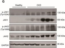 Fig.6.G showing Western Blotting from the publication: ACLY-Driven Metabolic Reprogramming Promotes Histone Acetylation and Inflammation-Associated Fibrosis in Chronic Kidney Disease.