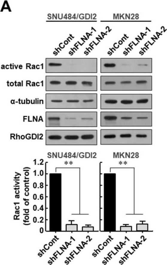 Fig.3.A showing Western Blotting in a Homo sapiens (Human) sample from the publication: RhoGDI2-Mediated Rac1 Recruitment to Filamin A Enhances Rac1 Activity and Promotes Invasive Abilities of Gastric Cancer Cells.
