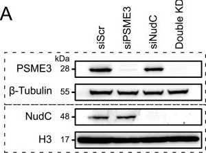 Fig.5.A showing Western Blotting in a Mus musculus (House mouse) sample from the publication: PSME3 regulates migration and differentiation of myoblasts.