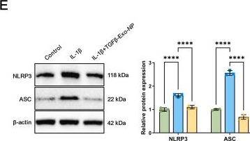 Fig.7.E showing Western Blotting from the publication: Epigenetic-metabolic coupling by SOX3/WDR5-SIRT5 signaling mediates the therapeutic effects of TGFβ-targeted exosomal nanoparticles in osteoarthritis.
