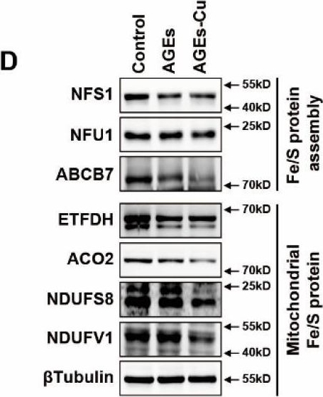 Fig.4.D showing Western Blotting from the publication: ATF3/SPI1/SLC31A1 Signaling Promotes Cuproptosis Induced by Advanced Glycosylation End Products in Diabetic Myocardial Injury.