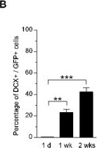 Fig.6.B from the publication: Intracerebral Transplantation of Neural Stem Cells Restores Manganese-Induced Cognitive Deficits in Mice.