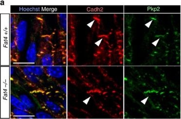 Amotl1 mediates sequestration of the Hippo effector Yap1 downstream of Fat4 to restrict heart growth.