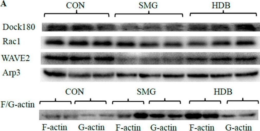 Fig.4.A showing Western Blotting from the publication: Dragon's Blood Regulates Rac1-WAVE2-Arp2/3 Signaling Pathway to Protect Rat Intestinal Epithelial Barrier Dysfunction Induced by Simulated Microgravity.