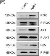 Fig.3.E showing Western Blotting from the publication: Astrocyte-derived Interleukin-31 causes poor prognosis in elderly patients with intracerebral hemorrhage.